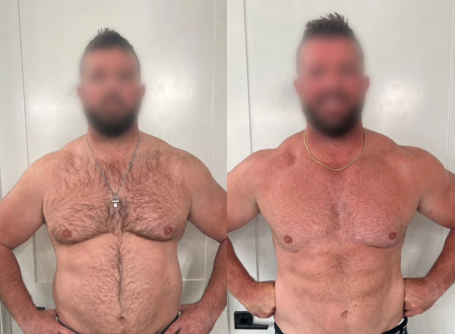 Antes e depois de aluno do Método Genesis com o rosto borrado